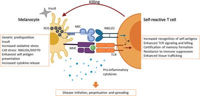 The Role of NKG2D in Vitiligo